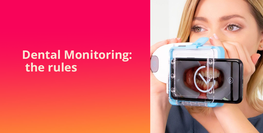 Dental Monitoring: the rules