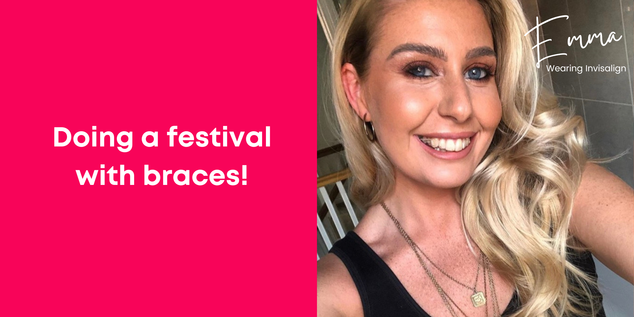 Doing a festival with braces